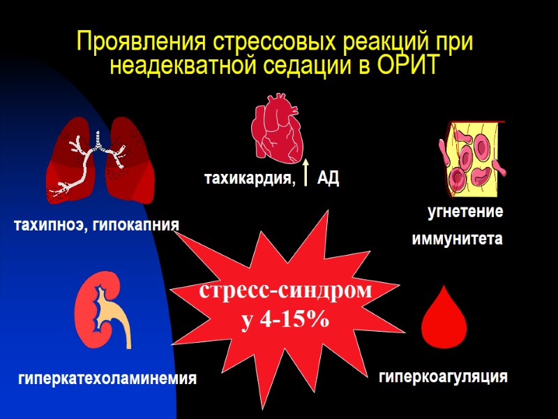 Проявления стрессовых реакций при неадекватной седации в ОРИТ стресс-синдром у 4-15% гиперкатехоламинемия  
